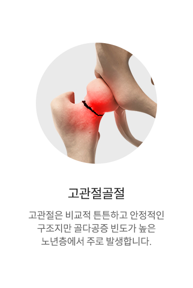 고관절골절