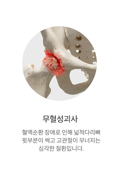 무혈성괴사