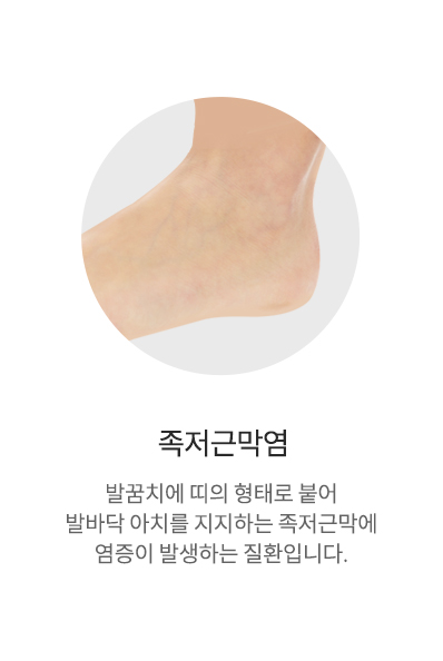 족저근막염