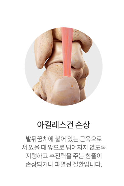 아킬레스건 손상