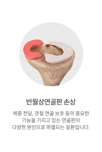 반월상연골판손상