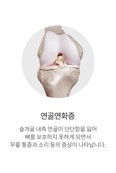 연골연화증