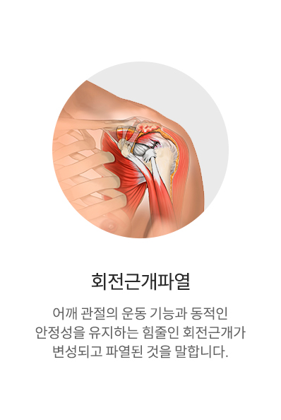 회전근개파열