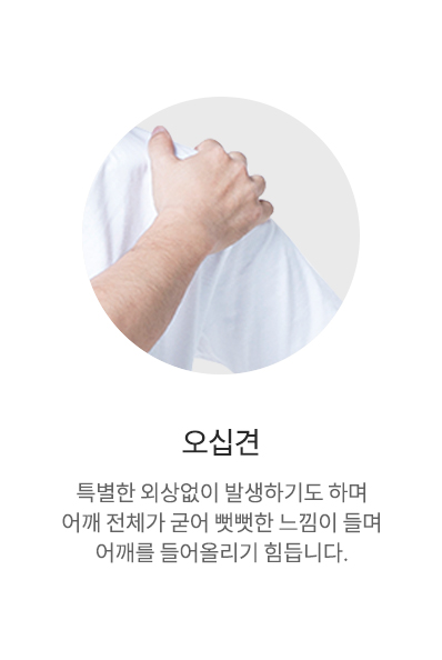 오십견