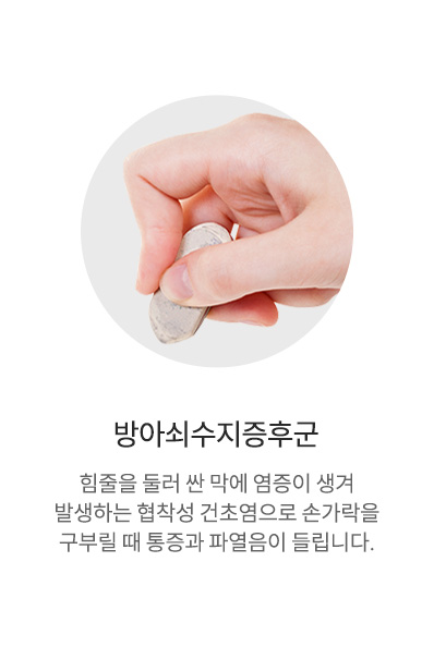 방아쇠수지증후군