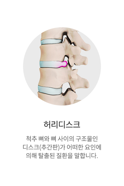 허리디스크