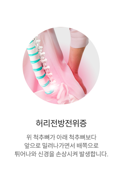 허리전방전위증