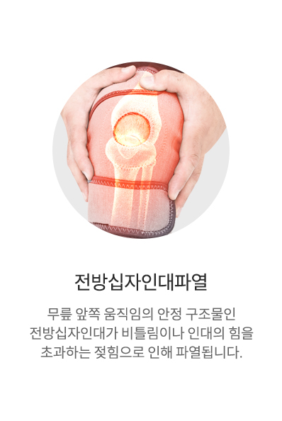 전방십자인대파열
